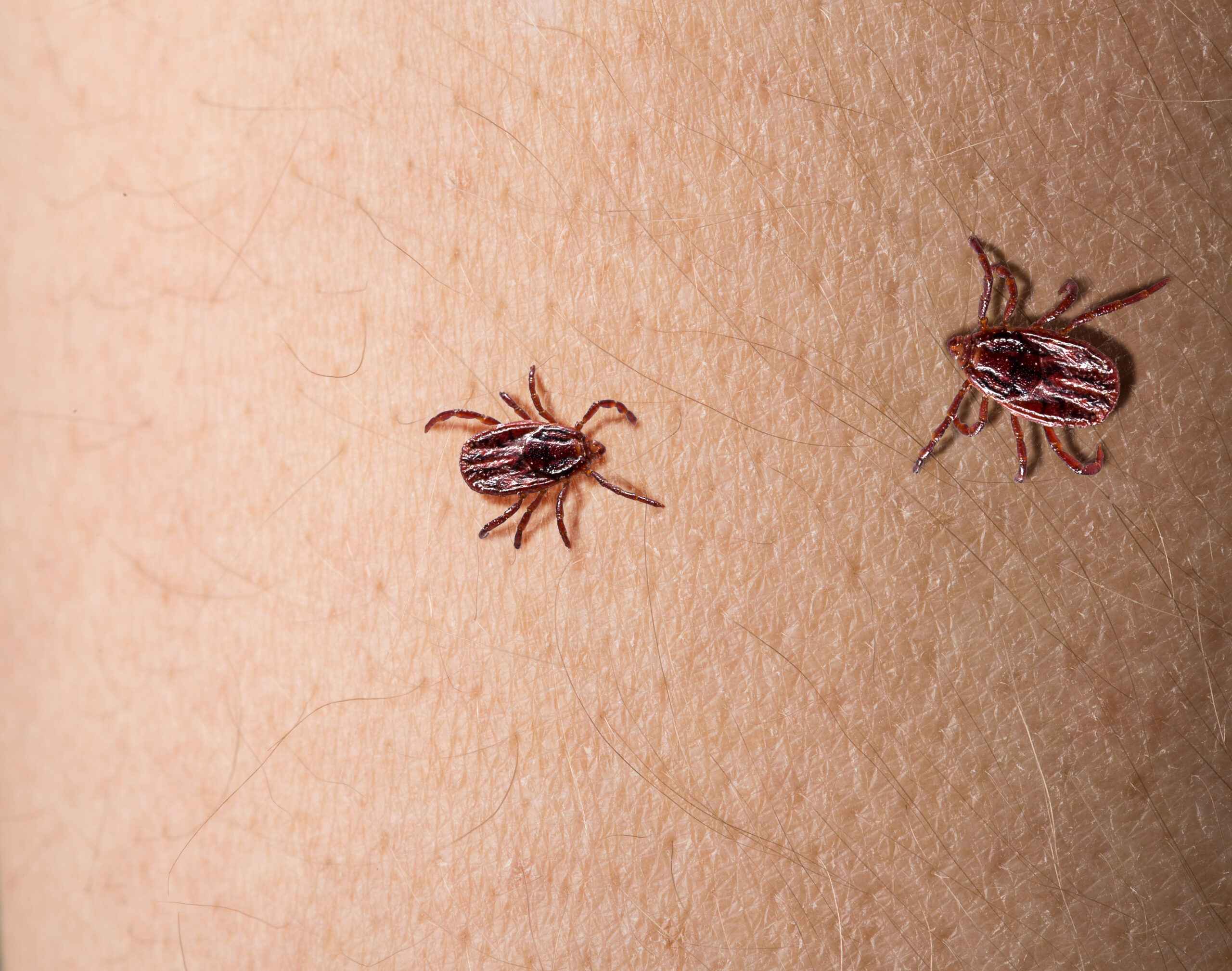 Viking Pest Control Urges New Jersey Residents To Prepare For Summer Pest Surge As Tick Populations Rise