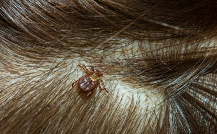 brown dog ticks
